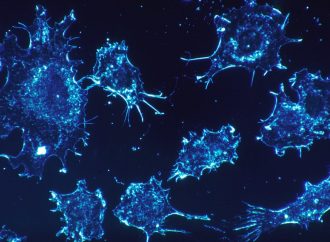 <strong>Investigadores israelíes .</strong> Descubren cómo deshabilitar las células cancerosas “Natural Killer”