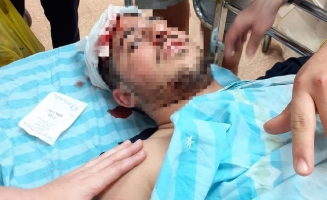 Dos bajurim de Yeshivá brutalmente golpeados por una pandilla violenta de beduinos