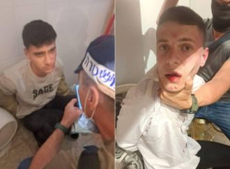 Heridos menores después de que terroristas embistieran a tres hareidim en Yerushalayim y se atascaron las ametralladoras