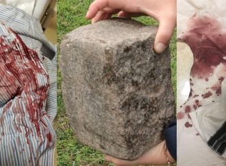 <strong>Antisemitimo en Estados Unidos.</strong> Rabino de Brooklyn de 64 años golpeado en la cabeza con ladrillo