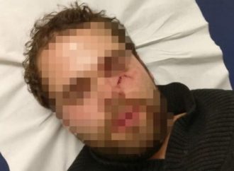 <strong>Antisemitismo.</strong> París: israelí golpeado hasta dejarlo inconsciente