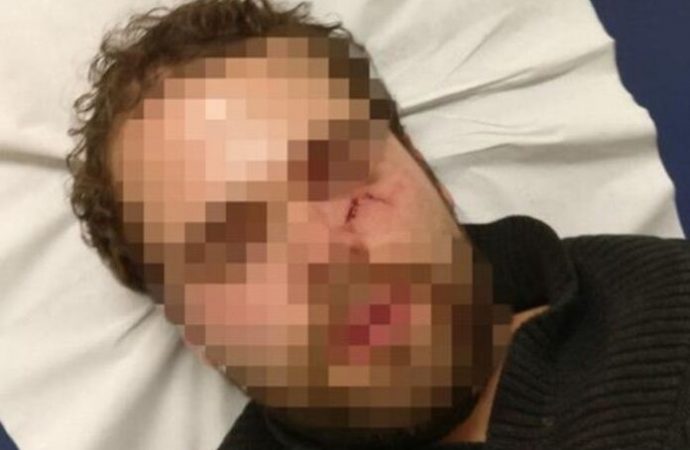 París: israelí golpeado hasta dejarlo inconsciente