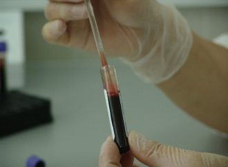 <strong>Universidad de Jerusalem.</strong> Investigadores israelíes desarrollan un análisis de sangre para diagnosticar la enfermedad de Parkinson