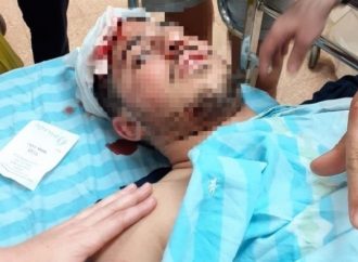 <strong>Ataque no provocado.</strong> Dos bajurim de Yeshivá brutalmente golpeados por una pandilla violenta de beduinos