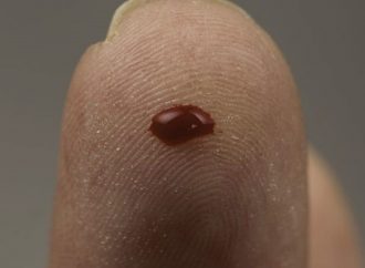 <strong>Aprobado en Estados Unidos.</strong> Startup israelí de análisis de sangre en diez minutos obtiene aprobación de la FDA