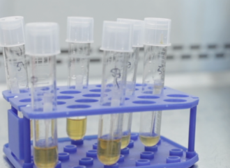 <strong>En Seattle.</strong> La prueba de la vacuna contra el coronavirus comenzará el lunes