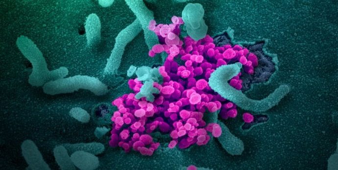 Científicos israelíes descubren que pacientes gravemente enfermos desarrollan anticuerpos COVID-19 más rápido