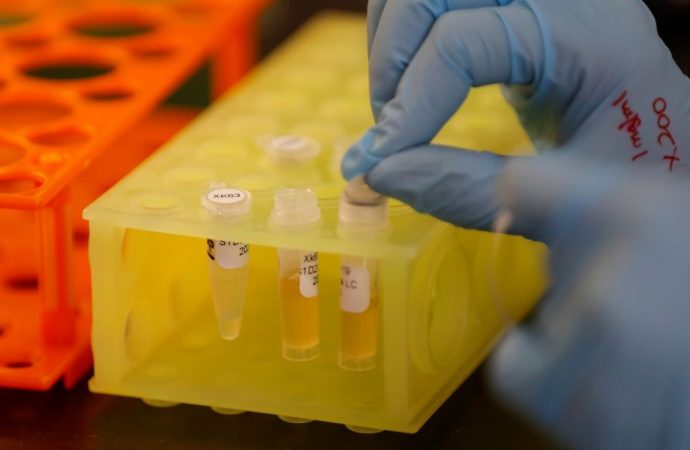 El próximo gran tratamiento para el COVID-19 pueden ser anticuerpos fabricados
