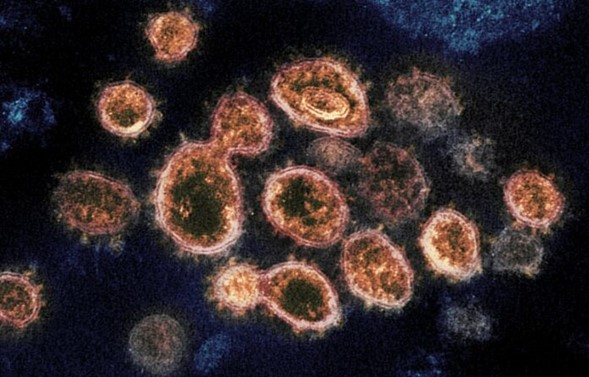 Tener COVID-19 puede proteger contra la reinfección