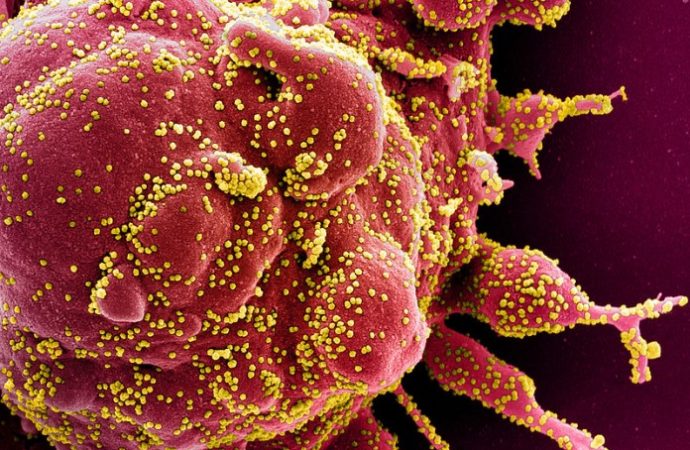 Investigadores israelíes identifican proteínas COVID-19 que dañan los vasos sanguíneos