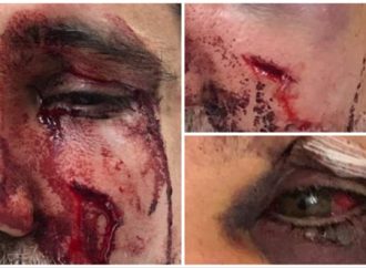 <strong>Enfermos de odio.</strong> Horror: Shalíaj de Jabad severamente golpeado por manifestantes izquierdistas [Video]