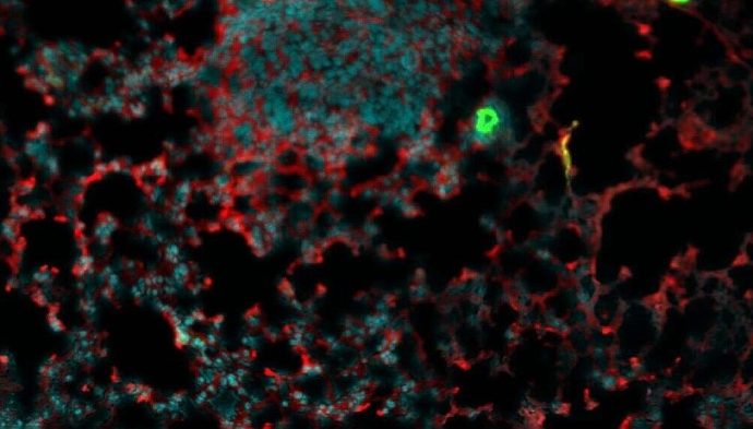 En Israel, un gran avance contra el cáncer, por “casualidad”