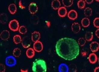 Un estudio liderado por la Universidad de Tel Aviv descubre un truco mortal del melanoma