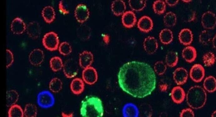 Un estudio liderado por la Universidad de Tel Aviv descubre un truco mortal del melanoma