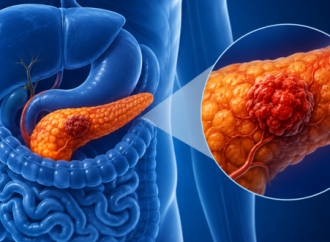 Hadassah: Nuevos ensayos sobre cáncer de páncreas muestran un control local de la enfermedad del 100%
