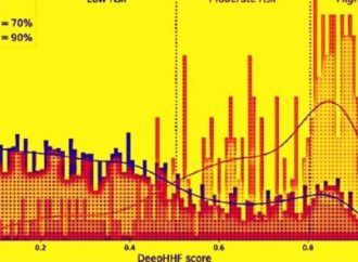Technion: Una IA israelí detecta con años de anticipación el riesgo de insuficiencia cardíaca